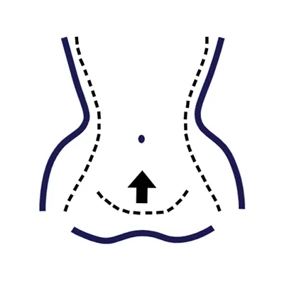 Img-cirujano-plastico-en-cali-Procedimientos-Iconos_Abdominoplastia