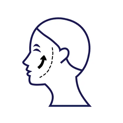 Img-cirujano-plastico-en-cali-Procedimientos-Iconos_Ritidoplastia