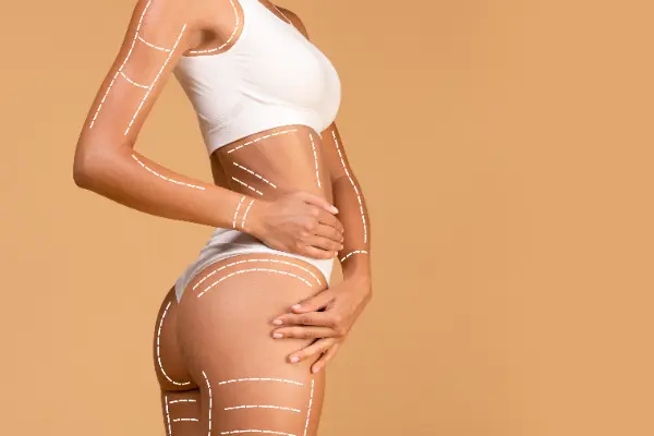 Si estás interesado en realzar la figura mediante la lipotransferencia en glúteos, seguramente deseas conocer cuánto tiempo dura la lipotransferencia en glúteos y qué cuidados son vitales para mantener los...